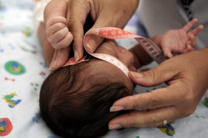 Audiência na Câmara discute cuidados com crianças que nasceram com microcefalia por causa do Zika vírus